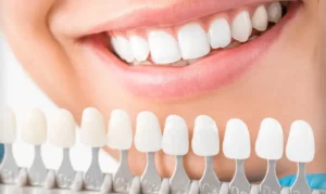 Why Aesthetic Dental Wellness is Essential for a Confident Smile